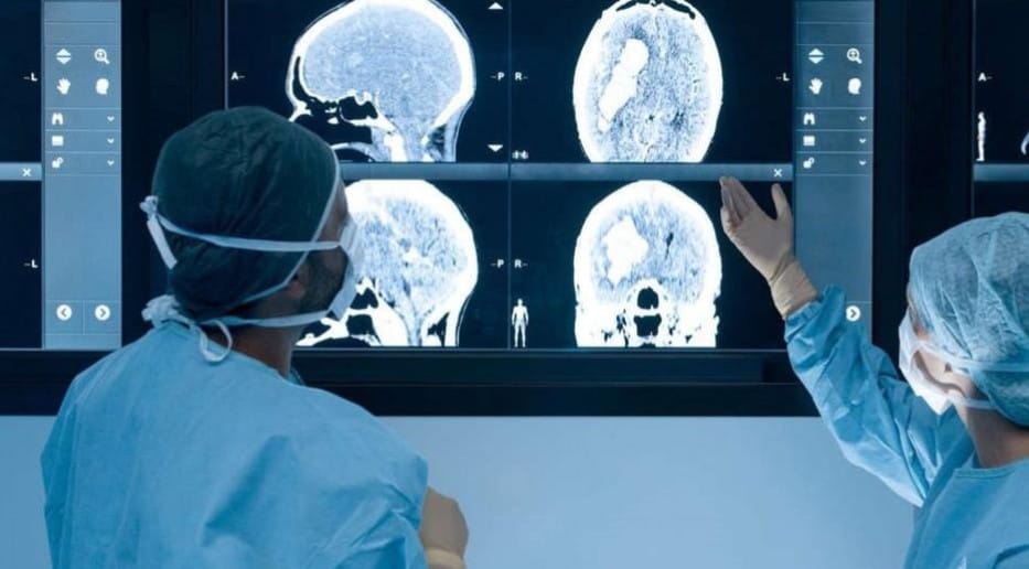 Covid: scoperti nuovi danni al cervello, anche nei malati lievi