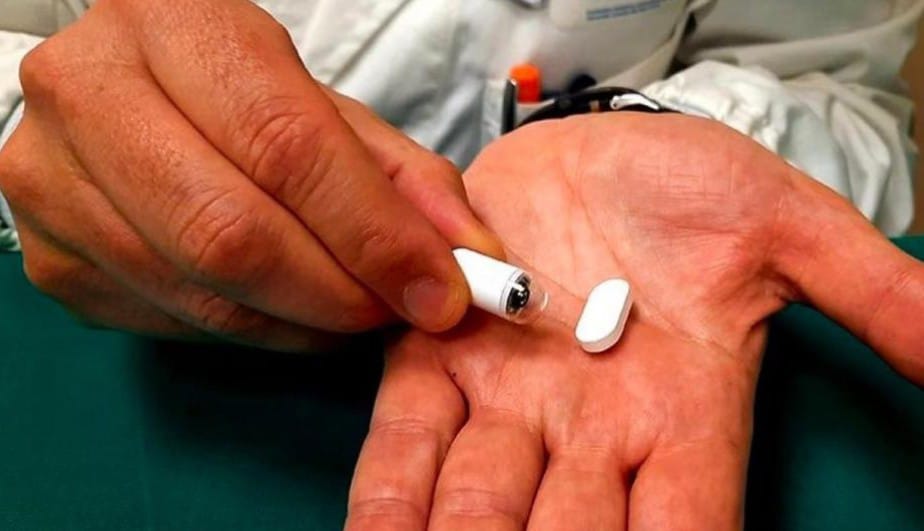 Gemelli, addio al tubo per la gastroscopia: arriva la video-pillola intelligente