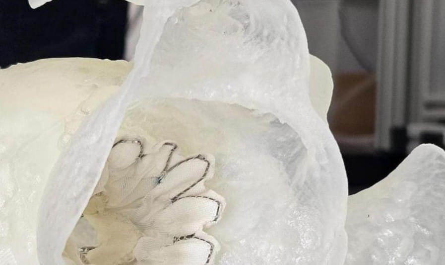Protesi in simultanea a cuore battente, ingegneri in aiuto dei chirurghi