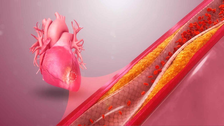 Il probiotico che riduce il colesterolo e pulisce le arterie la scoperta dei ricercatori di Harvard