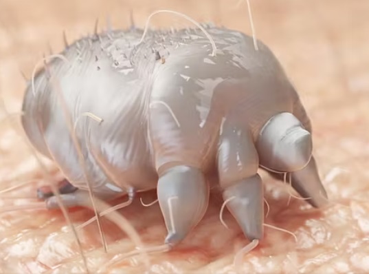 Allarme Scabbia in Italia: è cresciuta del 750% negli ultimi 3 anni