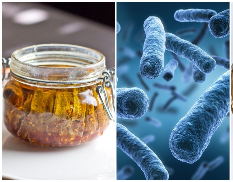 Intossicazione da botulino, tutto quello che bisogna sapere